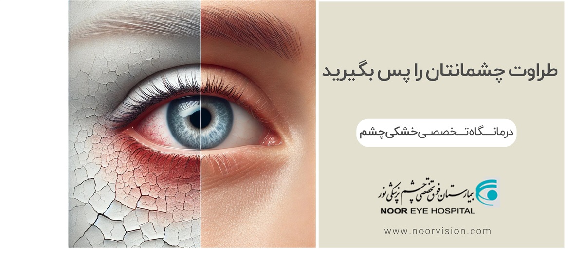 خشکی چشم