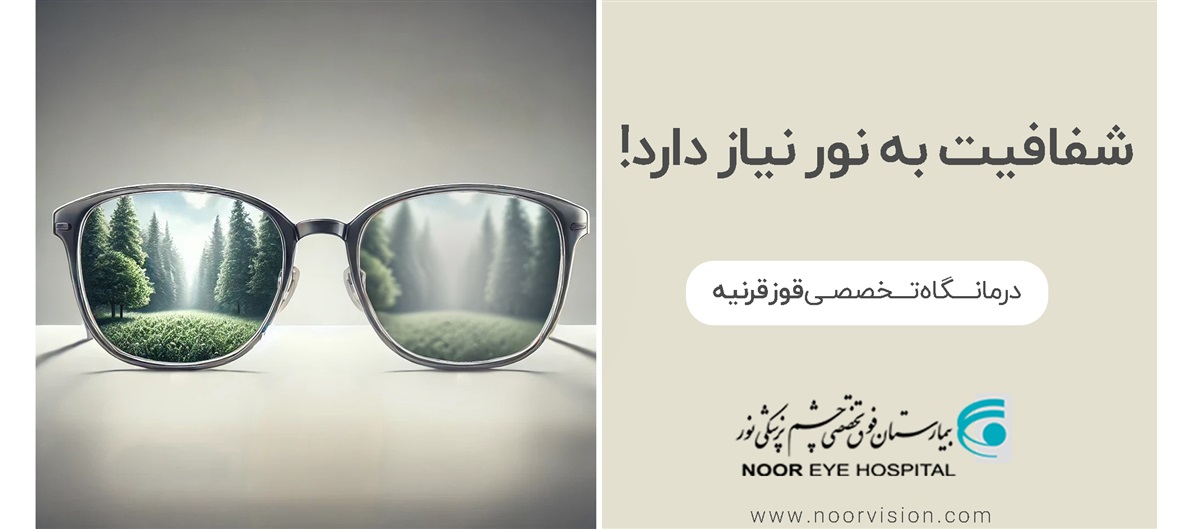 تبلیغ قوز قرنیه